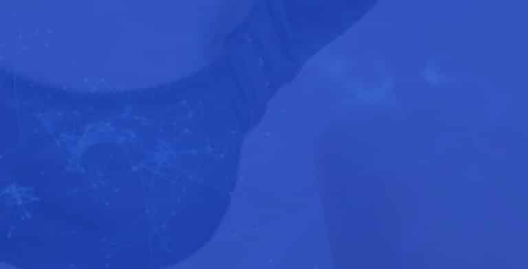Mastectomy Pongratz Orthotics Prosthetics