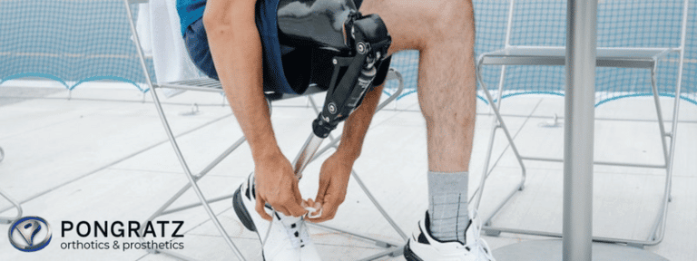 Suspension System For Prosthetic Limbs Pongratz Orthotics Prosthetics