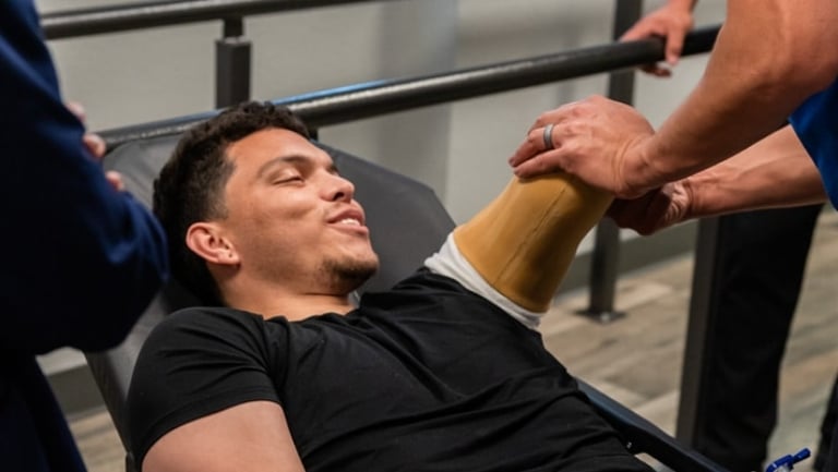 how are prosthetic arms attached to the body