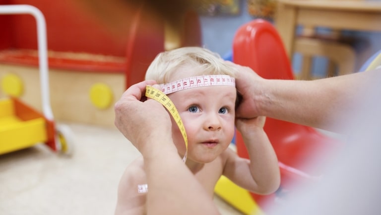 Are Cranial Helmets Worth It?