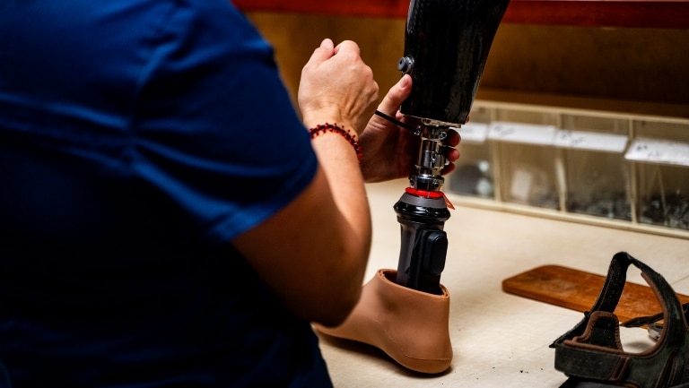 what are the most common causes of amputations