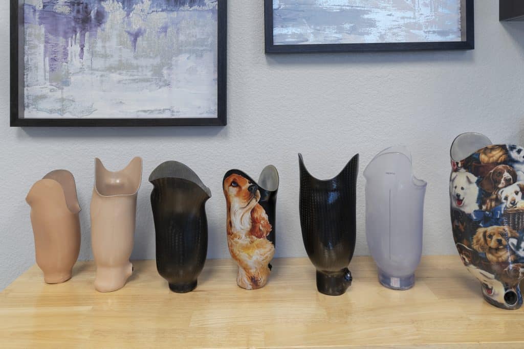 The Differences Between Pin-Lock, Suction, and Vacuum Prosthetic Suspension Systems